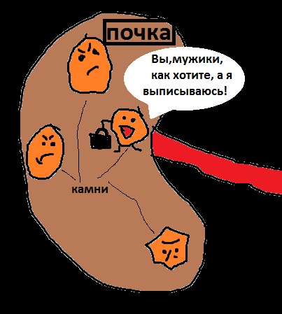 Карикатура: Камень из почки пошёл выписываться, Невзоров Александр