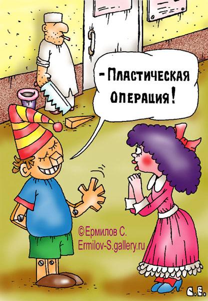 Карикатура: Пластика, Сергей Ермилов